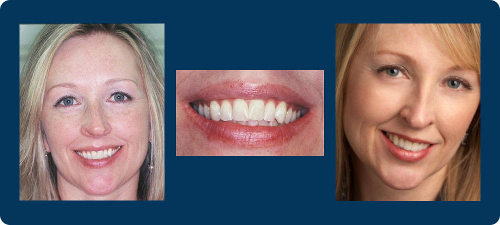 3 before and afters pictures of a female patient of Dr. Koutsioukis